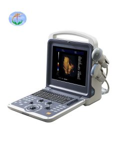 4d color doppler ultrasound scanner